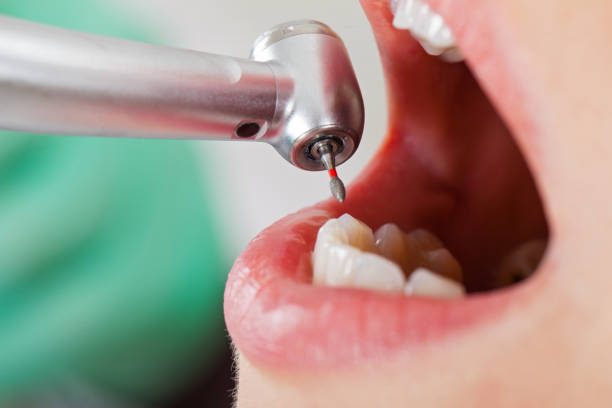 Best Emergency Treatment for Dental Infections or Abscesses in Lyons, NJ